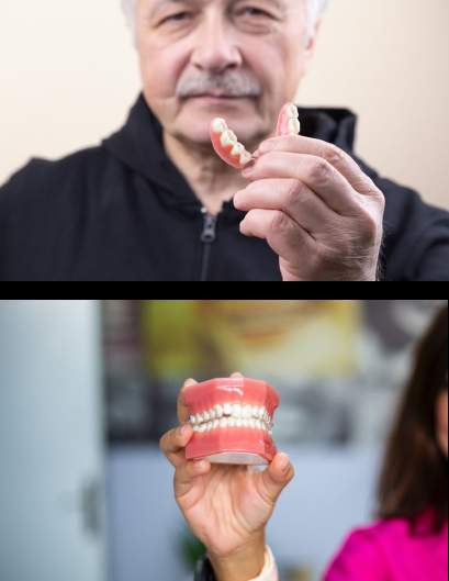 Dentures - False teeth