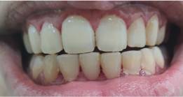 After image - Thyme Dental