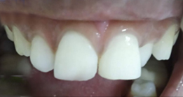 After Thyme dental treatment
