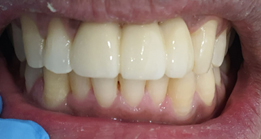 After Dental care Thyme Dental