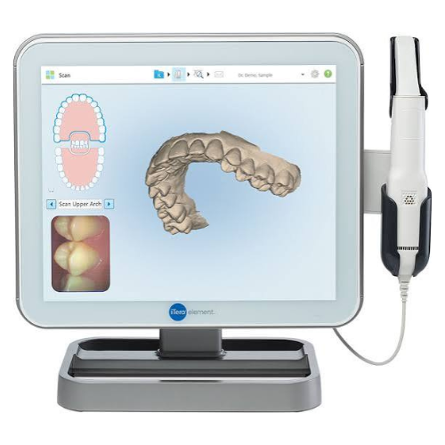 iTero 3D intraoral scanner showing a digital scan of teeth